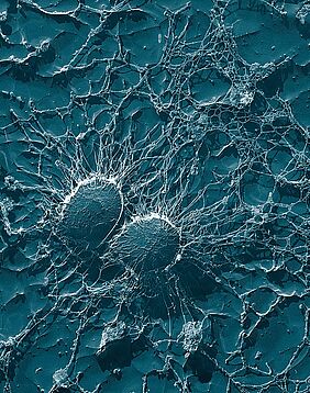 Staphylococcus aureus. Credits: Eric Erbe, Christopher Pooley/Wikipedia