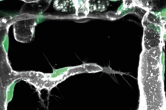 Bild einer aktiven Pionierzelle (Mitte des Bildes). Der Endothelzellkern ist grün, der Umriss der Blutgefäße grau. (Foto: Zoologisches Institut, KIT)